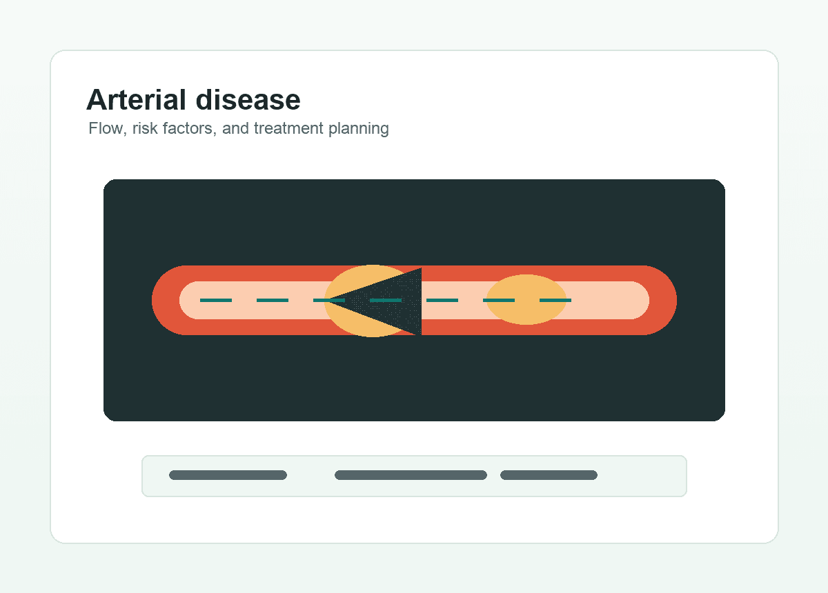 Arterial disease flow illustration