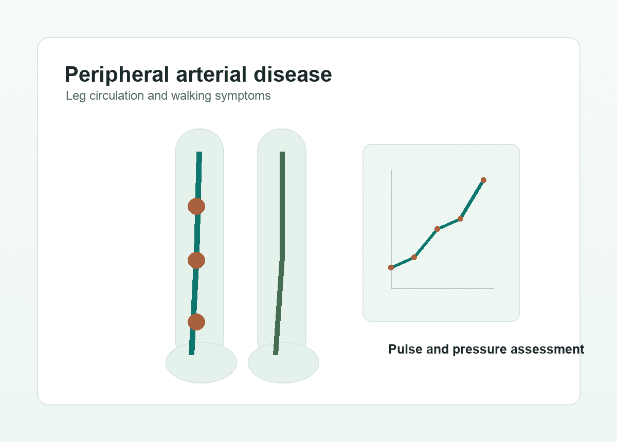 Peripheral arterial disease illustration with leg circulation and walking assessment chart