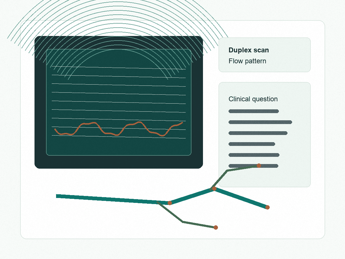Vascular ultrasound diagnostic screen illustration